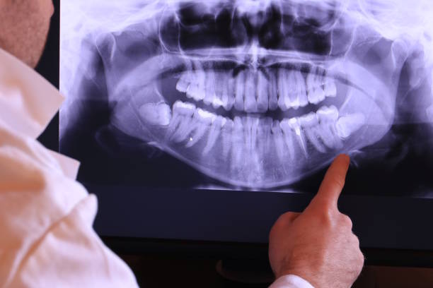 Best Emergency Treatment for Toothache in Withamsville, OH