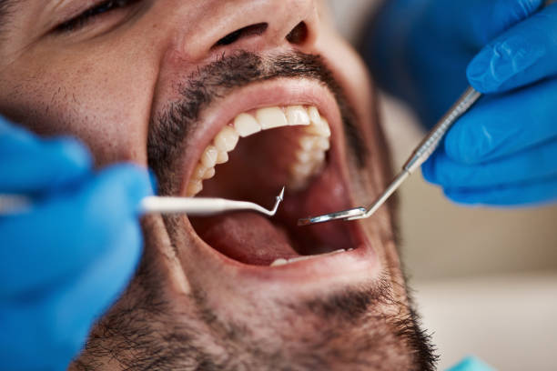 Best Emergency Broken Tooth Repair in Withamsville, OH