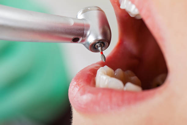 Best Weekend Emergency Dentist in Withamsville, OH